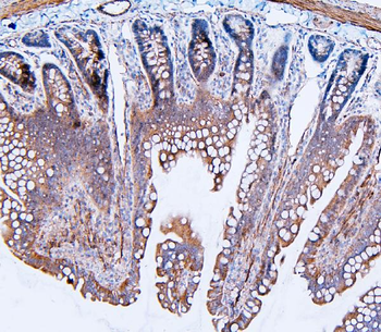 Filamin B/FLNB Rabbit Polyclonal Antibody