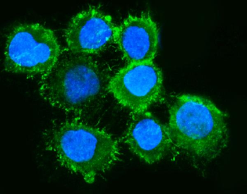 Moesin/MSN Mouse Monoclonal Antibody