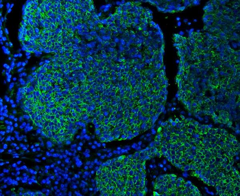Cytokeratin 5 Mouse Monoclonal Antibody