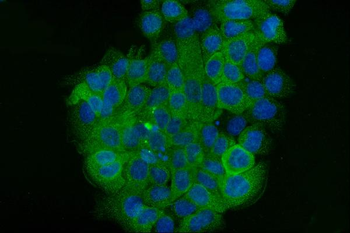 Cytokeratin 5 Mouse Monoclonal Antibody