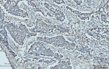 Cytokeratin 5 Mouse Monoclonal Antibody