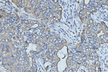 Cytokeratin 5 Mouse Monoclonal Antibody