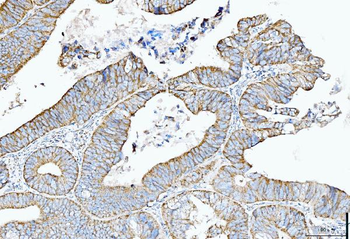 Cytokeratin 5 Mouse Monoclonal Antibody