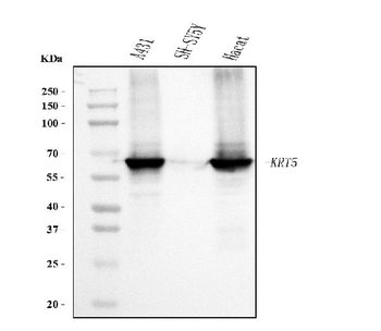 Cytokeratin 5 Mouse Monoclonal Antibody