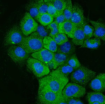 Cytokeratin 5 Mouse Monoclonal Antibody