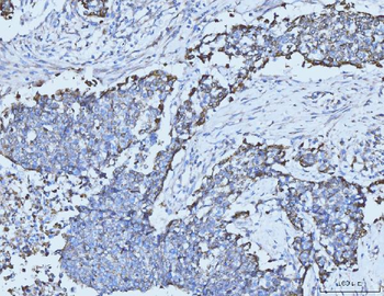 Cytokeratin 5 Mouse Monoclonal Antibody