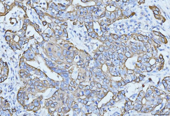 Cytokeratin 5 Mouse Monoclonal Antibody