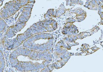 Cytokeratin 5 Mouse Monoclonal Antibody