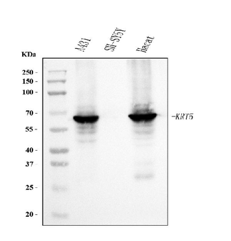 Cytokeratin 5 Mouse Monoclonal Antibody