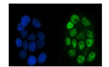 p95 NBS1 Mouse Monoclonal Antibody
