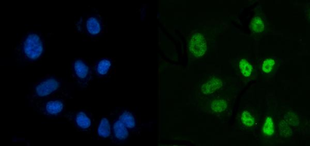 CTBP2 Mouse Monoclonal Antibody