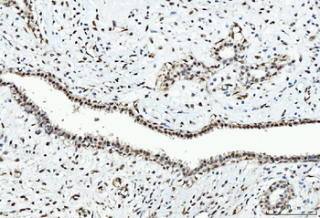 CTBP2 Mouse Monoclonal Antibody