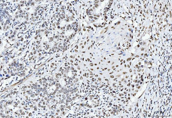 CTBP2 Mouse Monoclonal Antibody