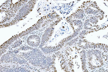 CTBP2 Mouse Monoclonal Antibody