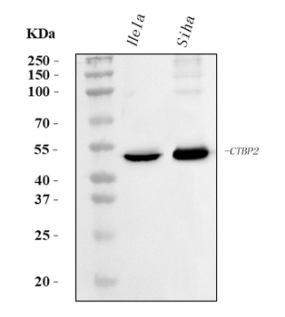 CTBP2 Mouse Monoclonal Antibody