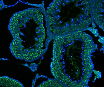 DDX4/MVH Mouse Monoclonal Antibody