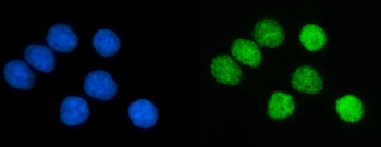 PCNA Mouse Monoclonal Antibody