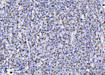 PCNA Mouse Monoclonal Antibody
