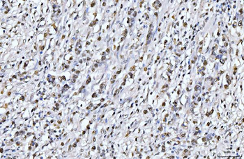 PCNA Mouse Monoclonal Antibody