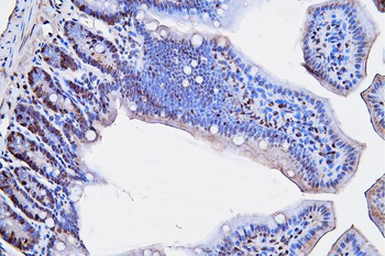 PCNA Mouse Monoclonal Antibody