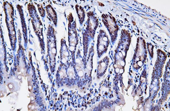 PCNA Mouse Monoclonal Antibody