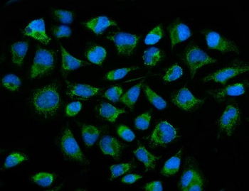 ACADM/MCAD Rabbit Polyclonal Antibody