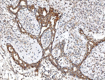 ACADM/MCAD Rabbit Polyclonal Antibody