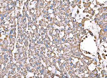 ACADM/MCAD Rabbit Polyclonal Antibody