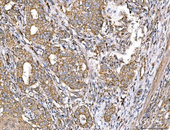 ACADM/MCAD Rabbit Polyclonal Antibody