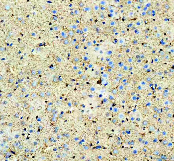 Aldolase C/ALDOC Rabbit Polyclonal Antibody