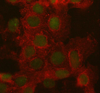 ARID1A Rabbit Polyclonal Antibody