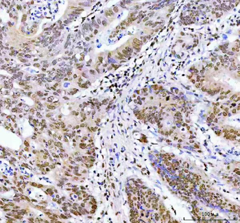 ARID1A Rabbit Polyclonal Antibody