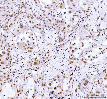 ARID1A Rabbit Polyclonal Antibody