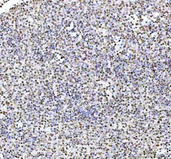 ARID1A Rabbit Polyclonal Antibody
