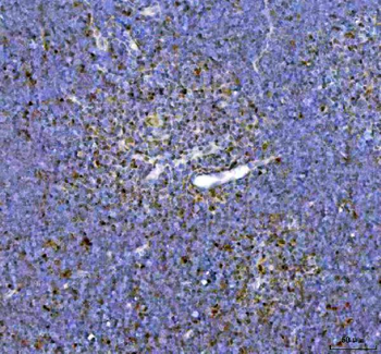 ARID1A Rabbit Polyclonal Antibody