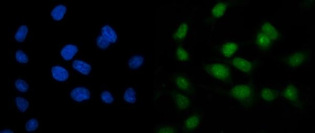 ARL6IP6 Rabbit Polyclonal Antibody