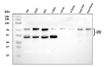 ATF2 Rabbit Polyclonal Antibody