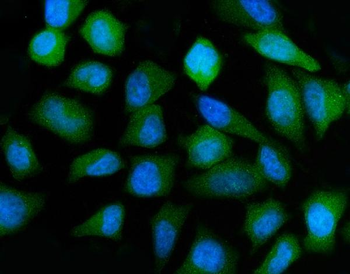 ATP6V1A Rabbit Polyclonal Antibody