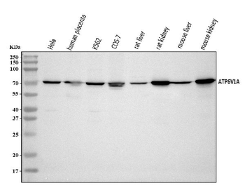 ATP6V1A Rabbit Polyclonal Antibody