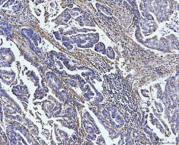 COL4A2 Antibody
