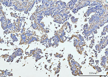 COL6A1 Rabbit Polyclonal Antibody
