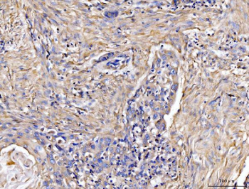 COL6A1 Rabbit Polyclonal Antibody