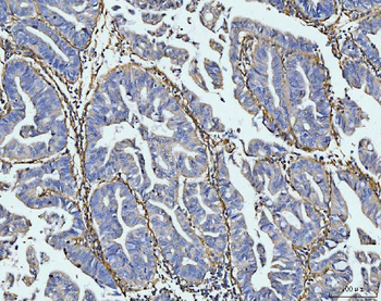 COL6A1 Rabbit Polyclonal Antibody