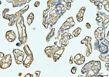 COL6A1 Rabbit Polyclonal Antibody