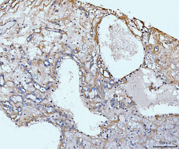COL6A1 Rabbit Polyclonal Antibody