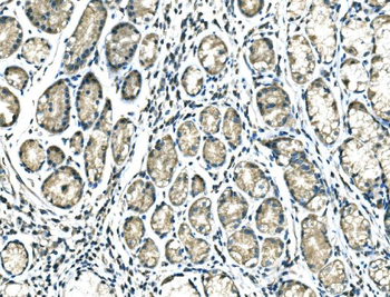 DROSHA Rabbit Polyclonal Antibody