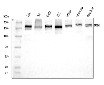 DROSHA Rabbit Polyclonal Antibody