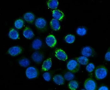 FXI/F11 Rabbit Polyclonal Antibody