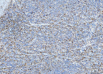 FHL2 Rabbit Polyclonal Antibody