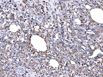 FHL2 Rabbit Polyclonal Antibody